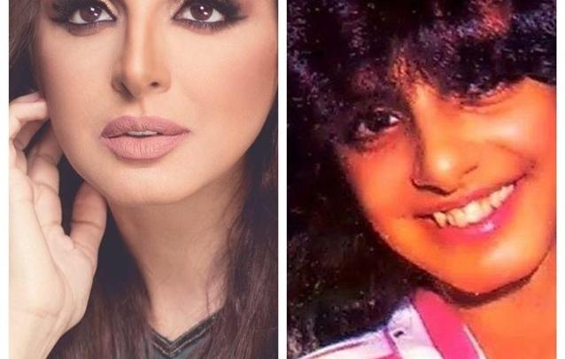 أنغام النجمة المصرية الشهيرة وتغير ملامحها مع الزمن مع عمليات التجميل