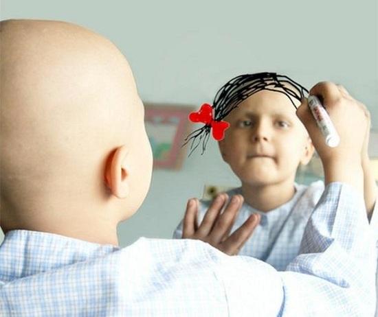 طفلة ترسم لنفسها شعرا في المرأة بعد ان فقدته لاصابتها بمرض السرطان